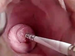 masturbating in the uterus
