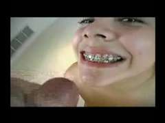 Spermaladung, Hässlich