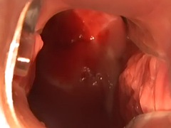 POV teen stretches pussy hole with medical dilator toy