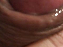 Close up forskin rolling with cumshot