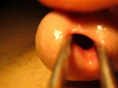 Urethral sounding and stretching with cumshot 2