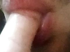 Oral massage uncut lip