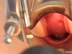 Inked amateur minx Alexis gyno exam fetish video