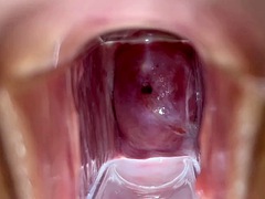 Sperma shot, Extreem, Fetisj, Gapende, Gynaecoloog, Hardcore, Slet, Speelgoed