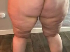 Cellulite GROUP 1