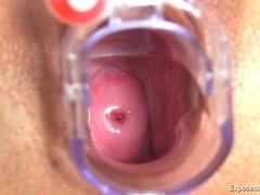 Brunette, Doctor, Masturbation, Nurse, Pussy, Solo, Stockings, Toys