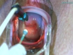 Kont, Blond, Gek, Arts, Fetisj, Gynaecoloog, Inshuiven, Mager