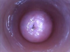 Insertion, Solo
