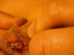 Little needles