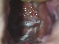 Gay anal internal hole world. Lube this hole with your sperm