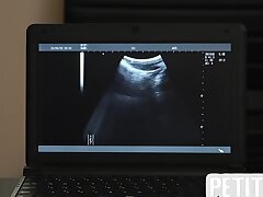 Tiny gayboy barebacked by handsome doctor on ultrasound