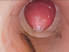 The Camera in the Deep Beaver Records a XXL Orgasm of Pearl juice Into the Protection