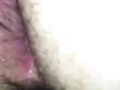 Hairy Hole