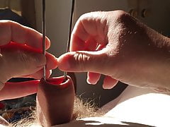 Sunshine foreskin - 4 of 8