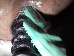 Extremely stretched anal canal