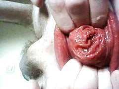 Playing with my meaty prolapse