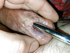 Subincision, sounding, estim