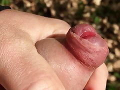 nice phimosis head