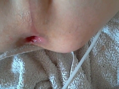 First Time Knotting My BD Toy - Gaping Twink6666