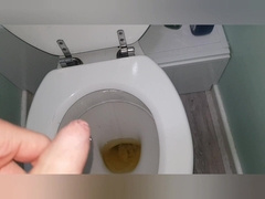 YELLOW URINATE FROM MY FAT KNOB