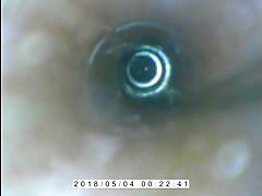 endoscope peehole cumflow