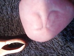 Marks after accuclamps