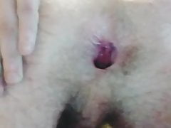 AGAIN ANAL PROLAPSE MY FUCKING GAY ASS
