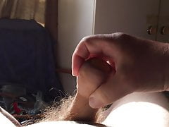 Sunshine foreskin - 6 of 8