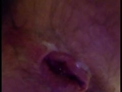 My Stretched Ass Has Pussy Lips