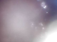 Anal endoscope