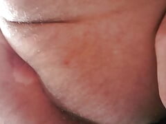 Dilation with a cone boypussy