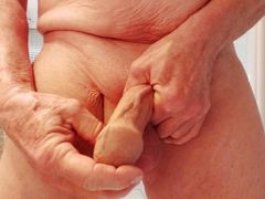 Genitals of a 73-year-old