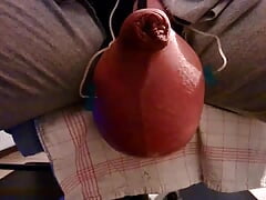 Glucose 5% 500 Ml, Saline 1500 Ml