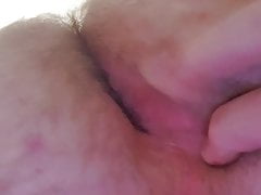 My Asshole