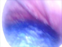 A few balls inside my ass