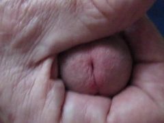 A cockslip for my patient