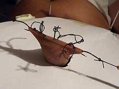 fishhook in foreskin