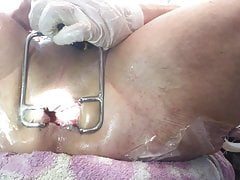 Anal Gape