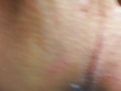 enema milk