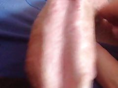 Erect Subincision.