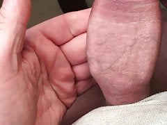 Standing foreskin - 1 of 4 - pliers