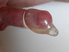filling a condome