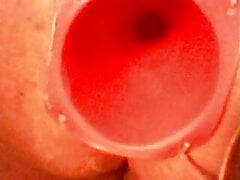 Old Anal stretching  clip (plastic cone)