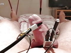 e-stim hfo juli2020