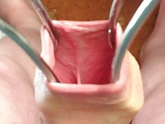 Foreskin in sunlight - 9 minute video