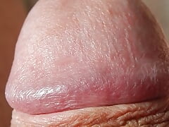 Wixen in close-up