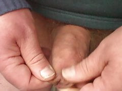 17 ballbearings in foreskin