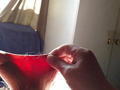Sunshine foreskin - 7 of 8