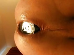 Anal blast