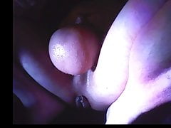2L Saline Rosebud Fist Cum